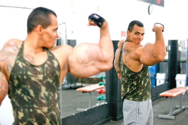 What Is Synthol? - Uses, Abuse And Injection Effects! 1